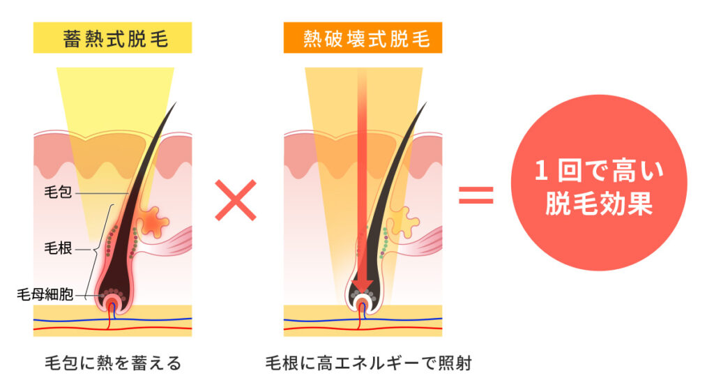 ヴィーナスワン(脱毛器)の特徴